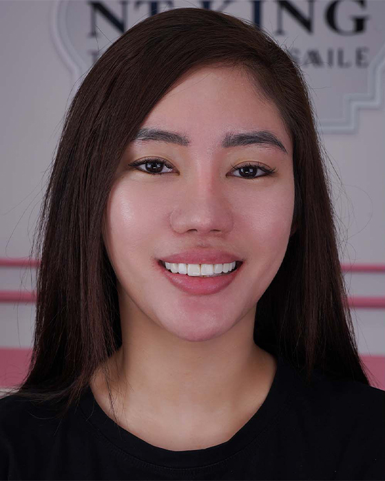 Chi-anjanet-m.dali---philipines_01